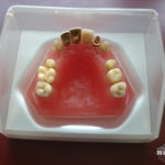 hillscollectibles-dentures1